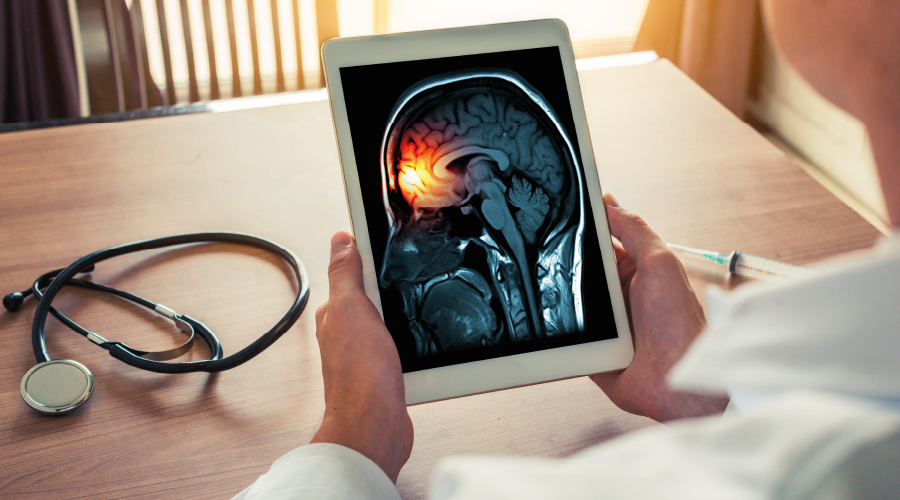 Menenjitte e-sigara şüphesi